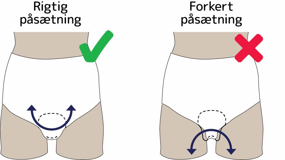 Guide til påsætning af urinbind